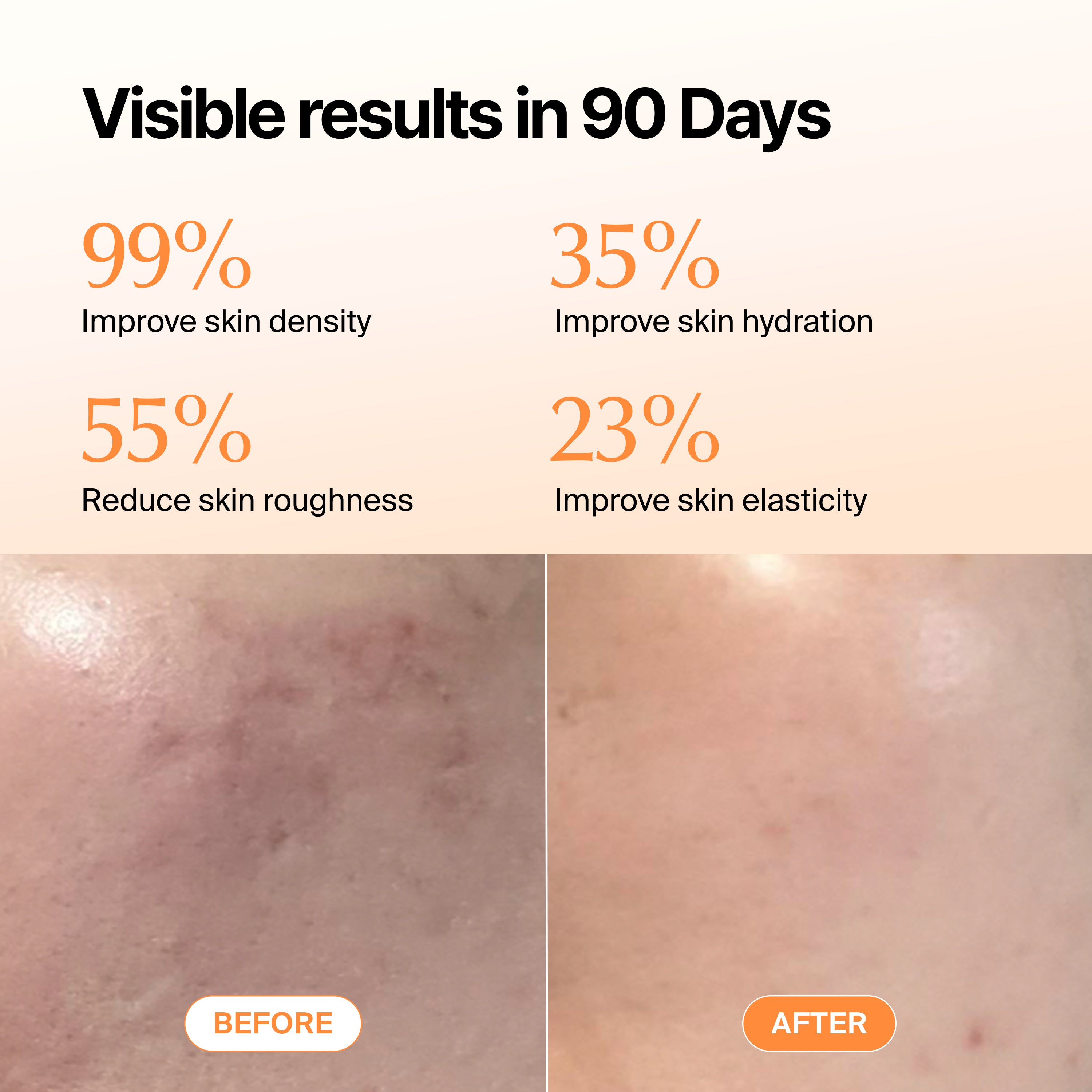 Triple Collagen Garden edition